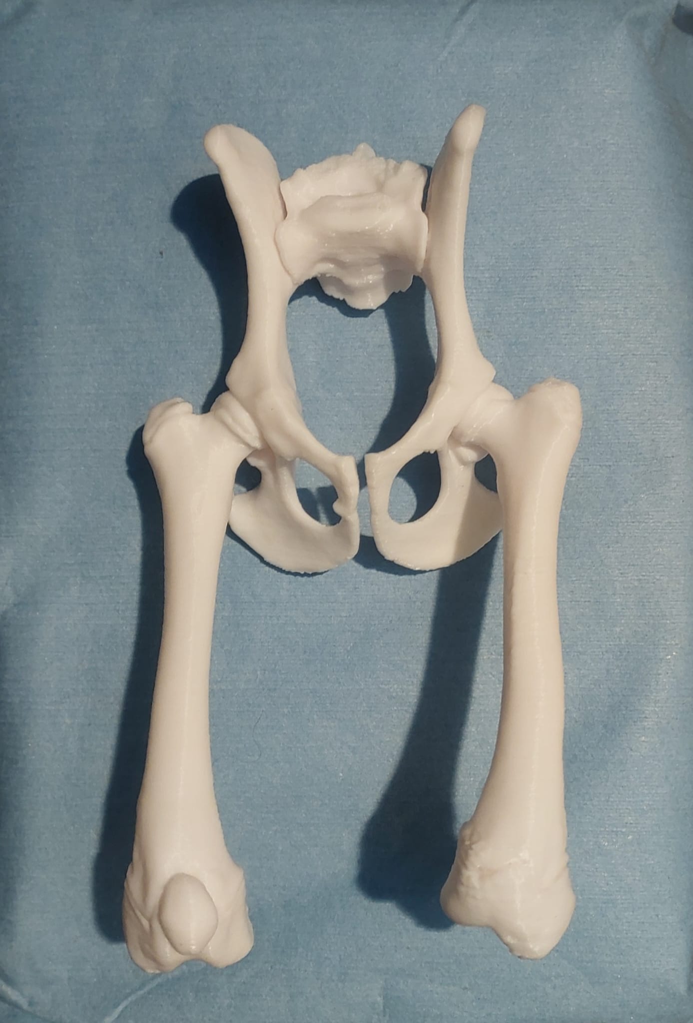 Modello stampato in 3D di bacino e femori, scala 1:1
