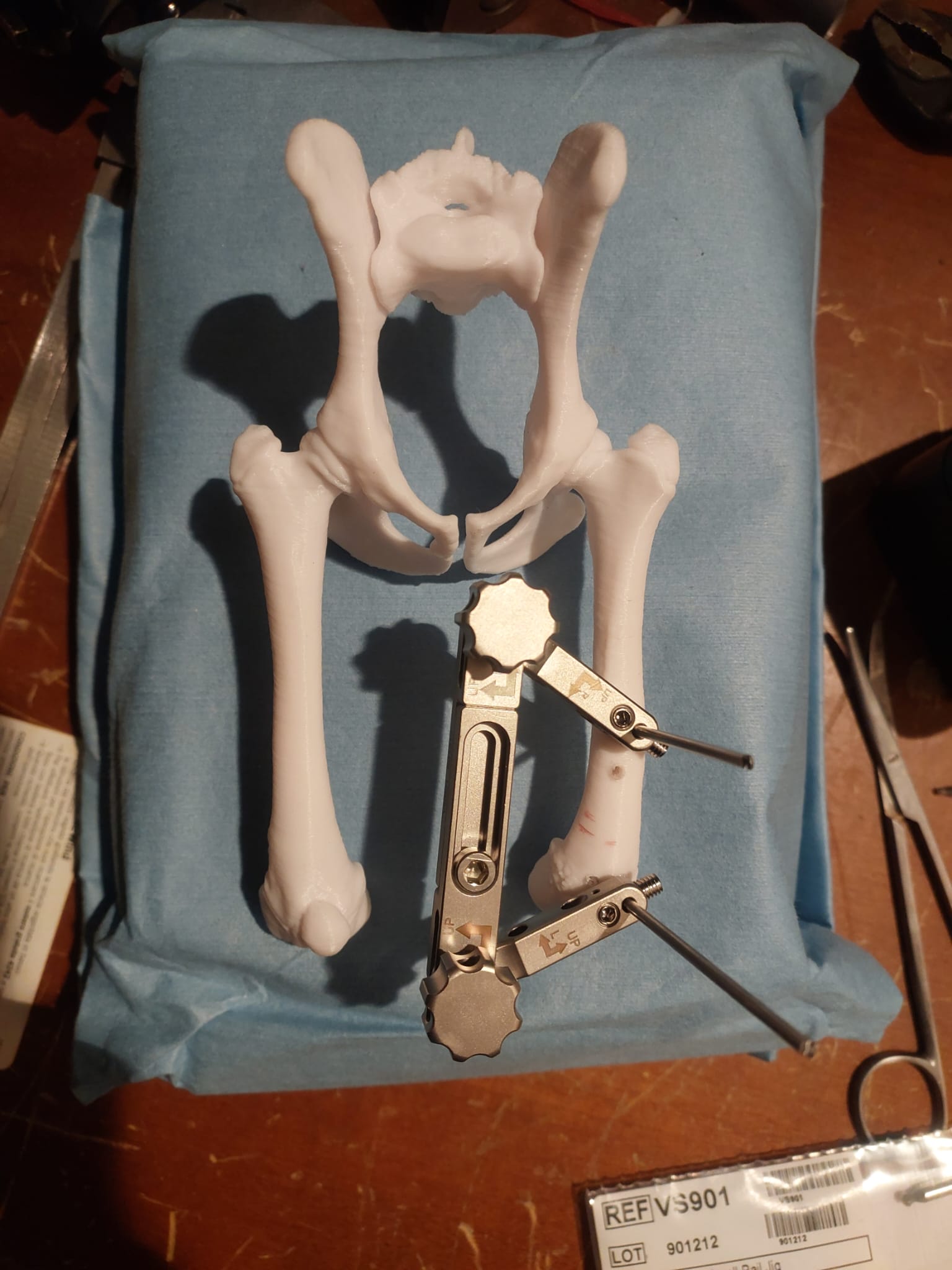 Fissatore esterno montato sul modello stampato del femore