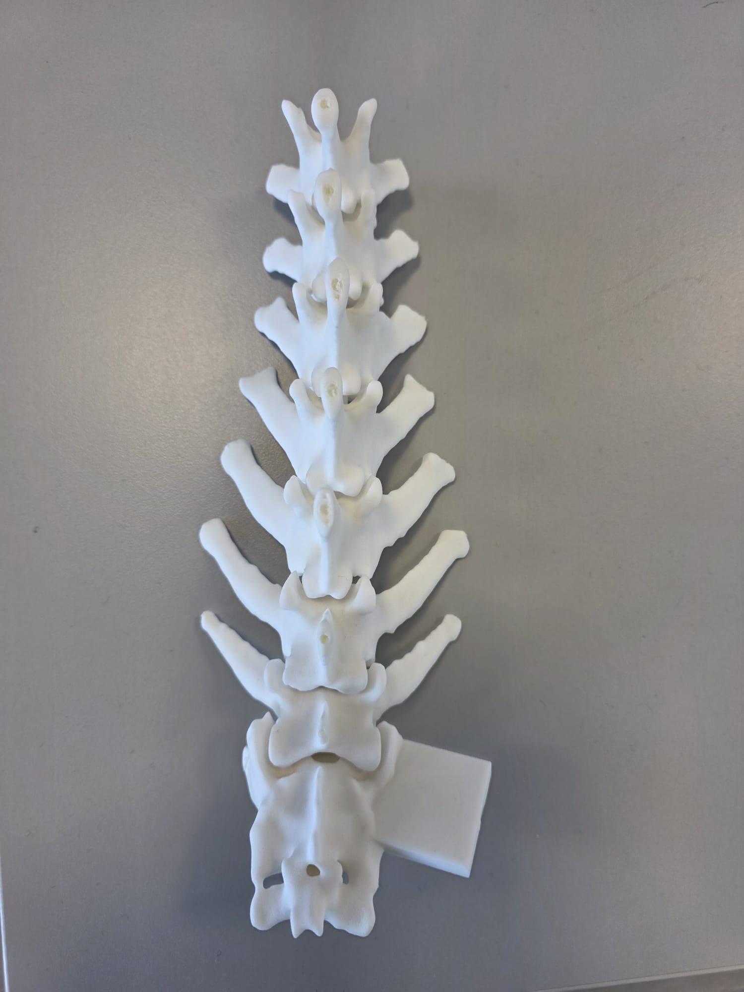 Modello stampato della colonna vertebrale