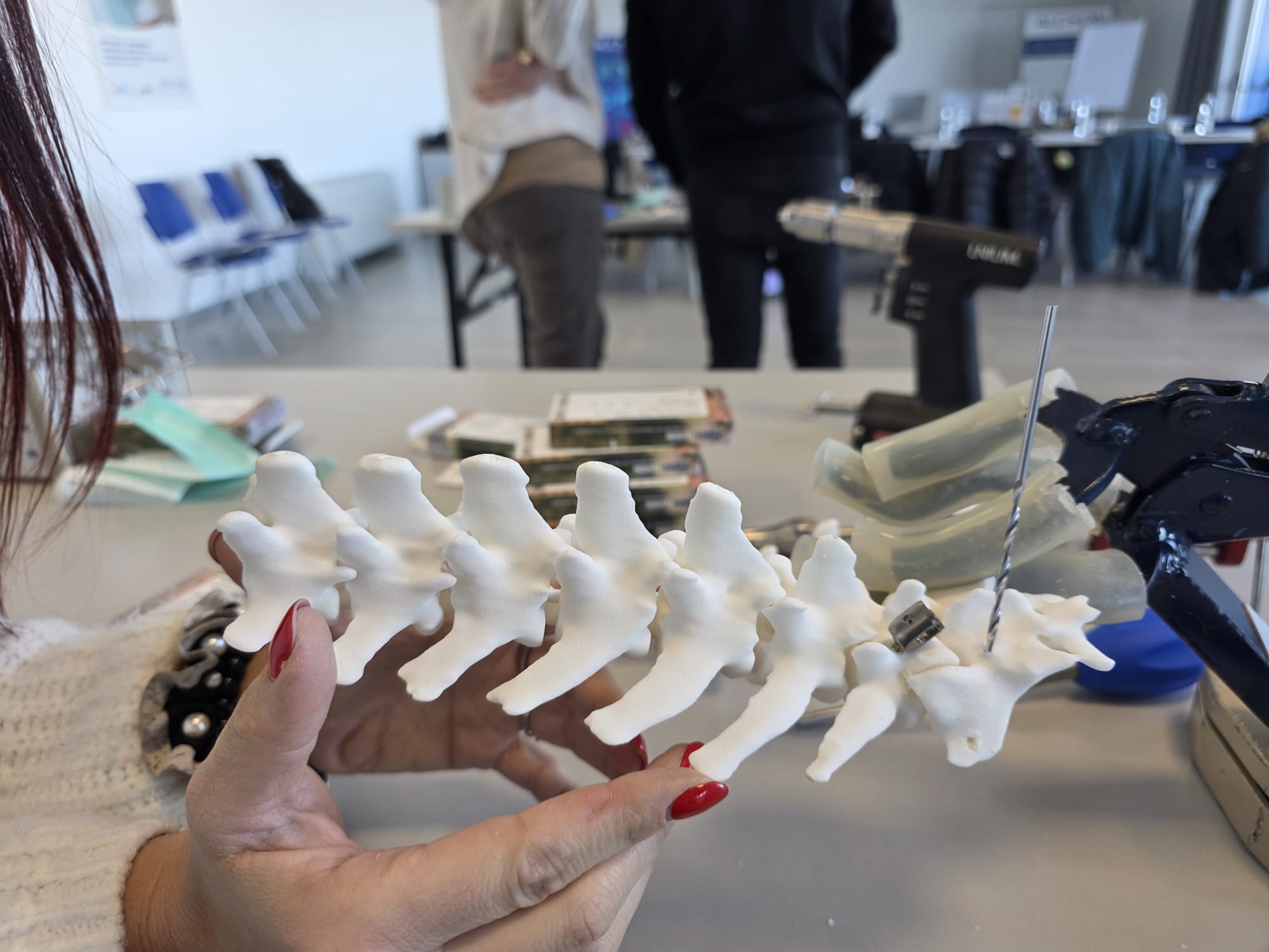 Modello appena stampato della colonna vertebrale, prima della rimozione dei supporti