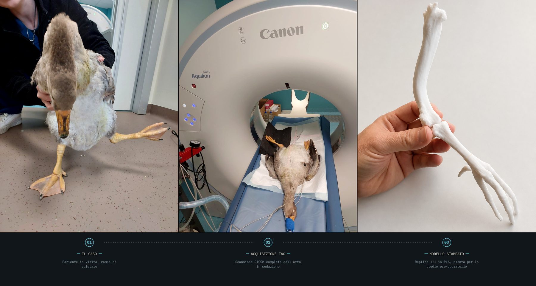 Caso reale: paziente in visita, acquisizione TAC su tomografo Canon Aquilion, modello dell'arto stampato in 3D tenuto in mano